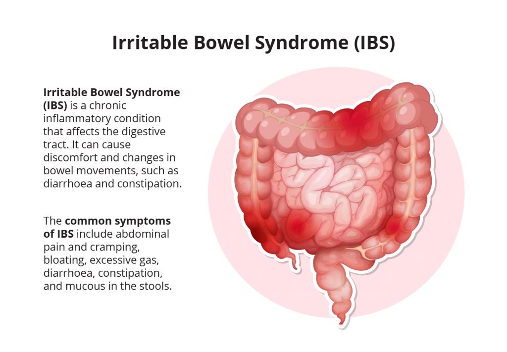 Irritable Bowel Syndrome (Diarrhoea)