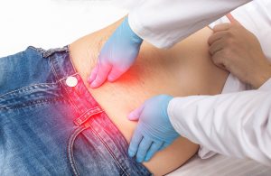 hernia-specialist-singapore