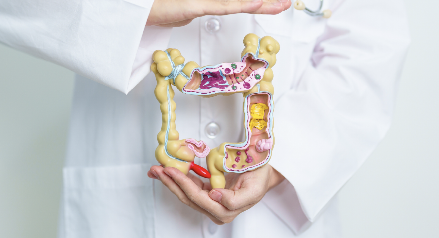 Managing Irritable Bowel Syndrome (IBS)- Effective Treatment Options in  Singapore | Aelius Surgical Centre