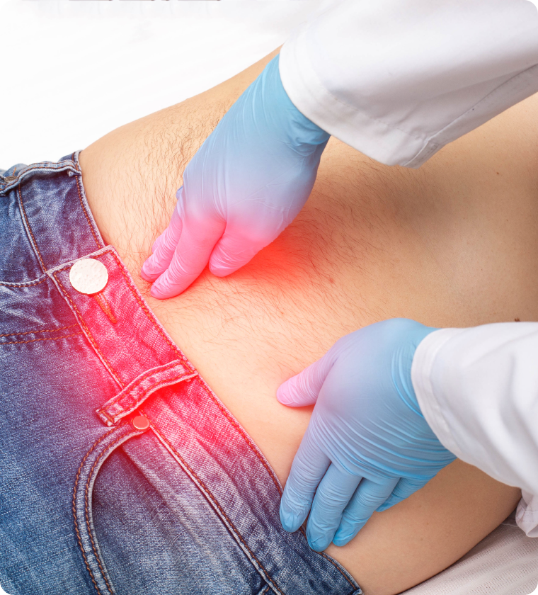 Hernia Surgery in Singapore- Effective Treatment for a Common Condition